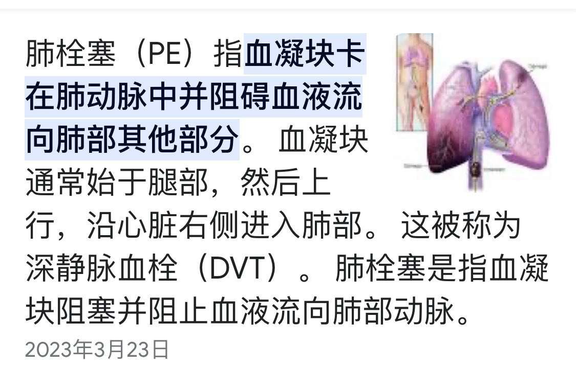 李玟是一位积极乐观向上的人，无法相信她会自杀