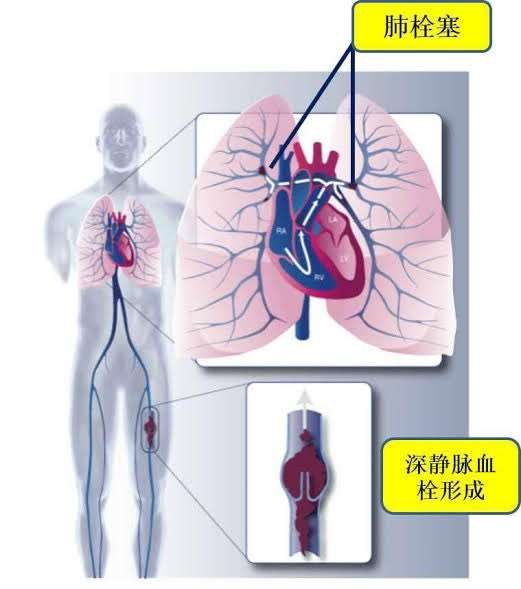 李玟是一位积极乐观向上的人，无法相信她会自杀