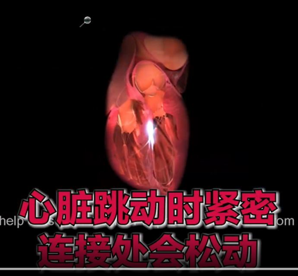 mRNA疫苗30天内就能造成心肌炎造成死亡!