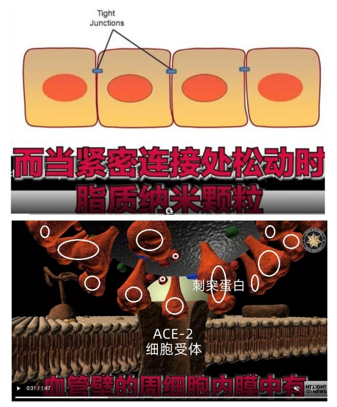 三篇文章详解新冠疫苗后遗症:心肌炎+血栓+脑雾 